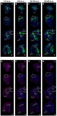 How the forebrain transitions to adulthood: developmental plasticity markers in a long-lived rodent reveal region diversity and the uniqueness of adolescence